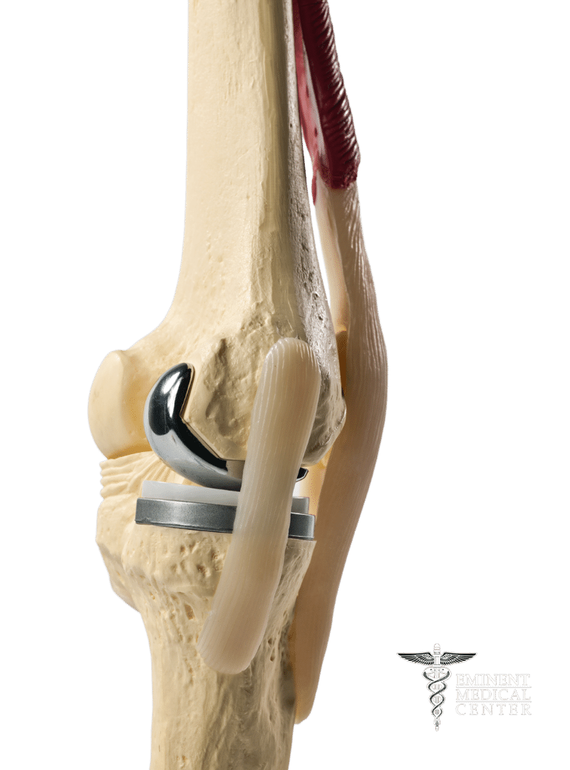 mako knee replacement center richardson