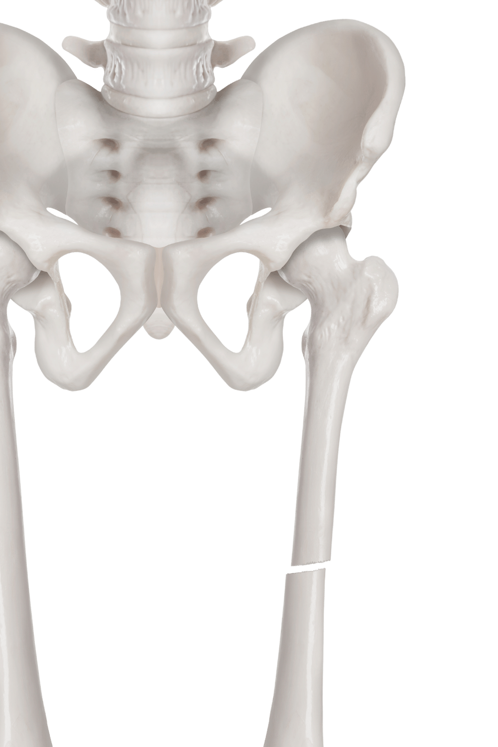 total hip replacement surgery center dallas