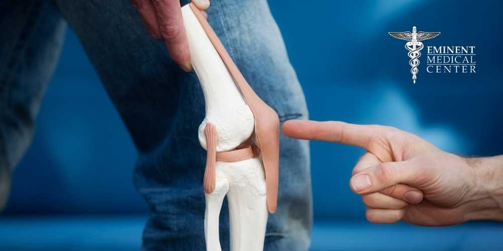 Knee Replacement Recovery Mistakes