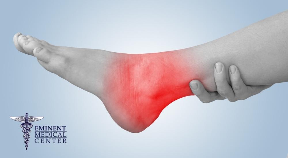 Dallas Ankle Fusion Surgery