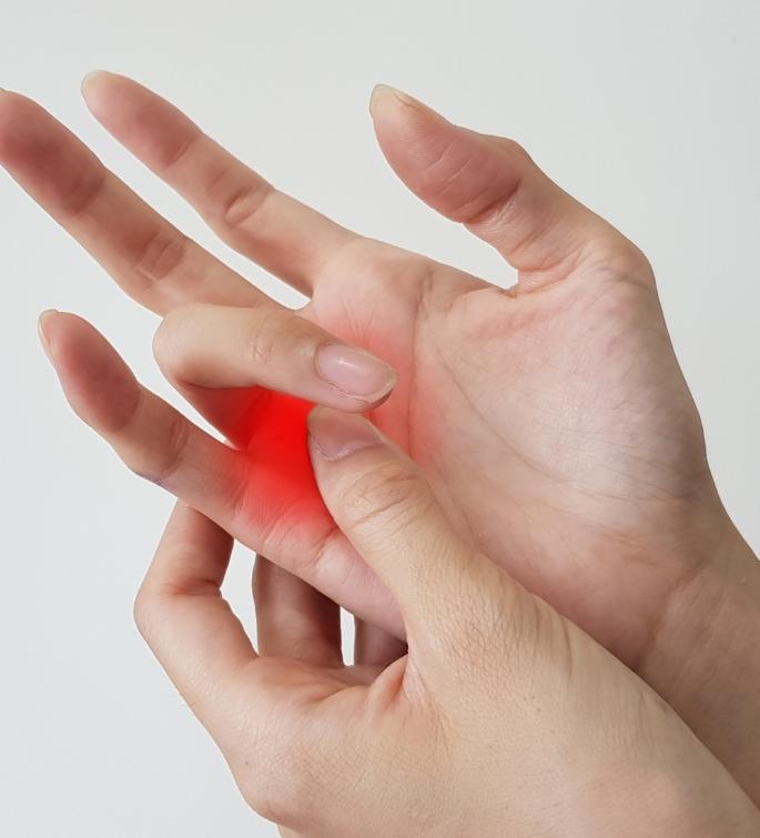 Trigger Finger Surgery Dallas