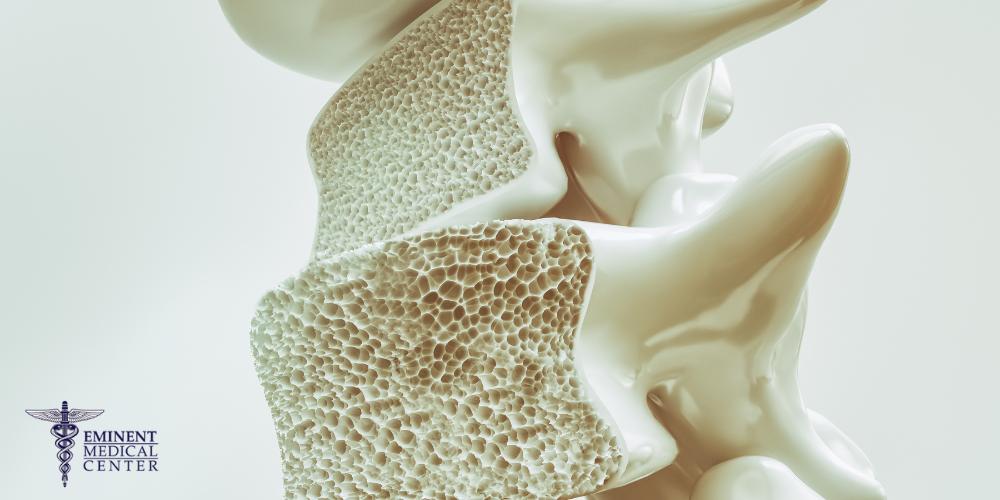 Vertebroplasty Dallas Texas