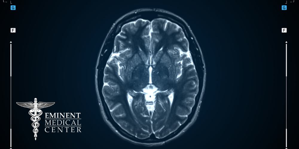 trigeminal neuralgia causes