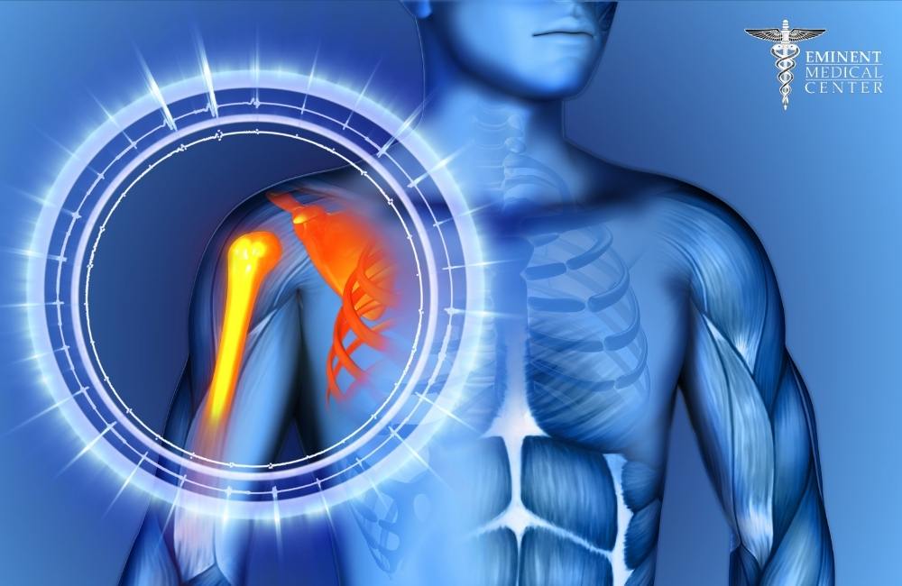 Shoulder Replacement Surgery Richardson, Texas