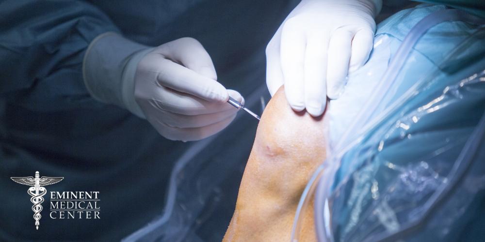 Knee Arthroscopy North Texas