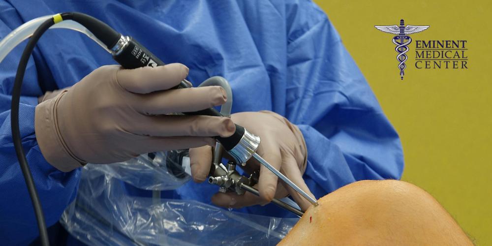 Knee Arthroscopy Richardson and Dallas Texas