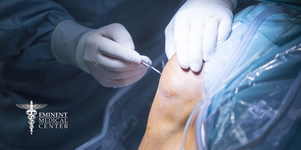 Dallas and Richardson TX Partial Knee Replacement Surgery