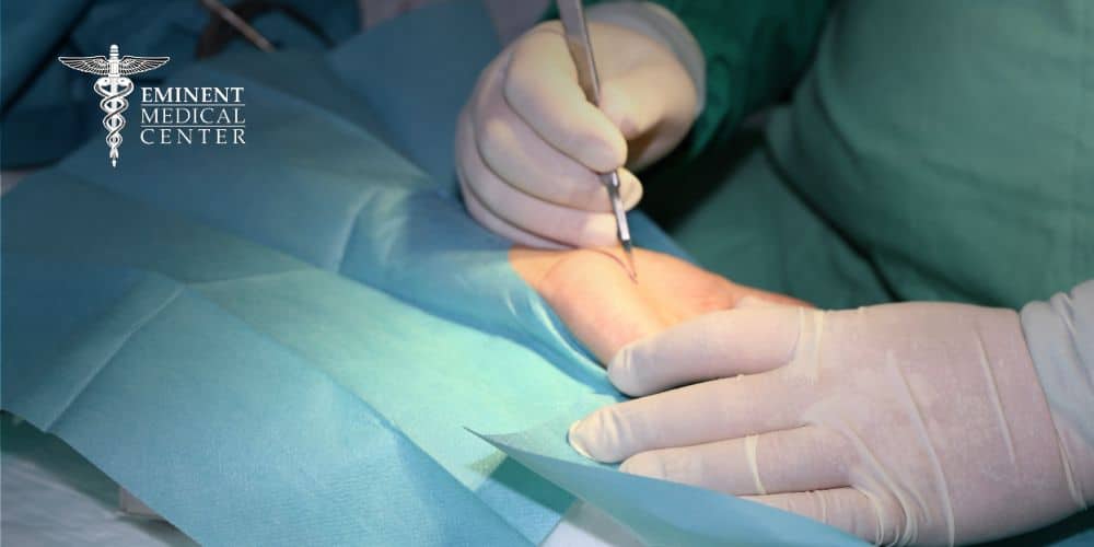 carpal tunnel surgery dallas tx