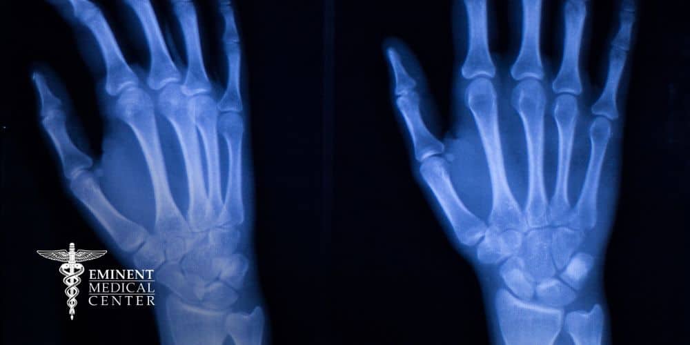 carpal tunnel surgery richardson tx
