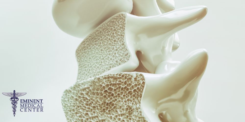 kyphoplasty surgery texas