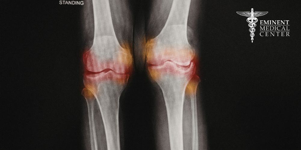torn meniscus repair dallas