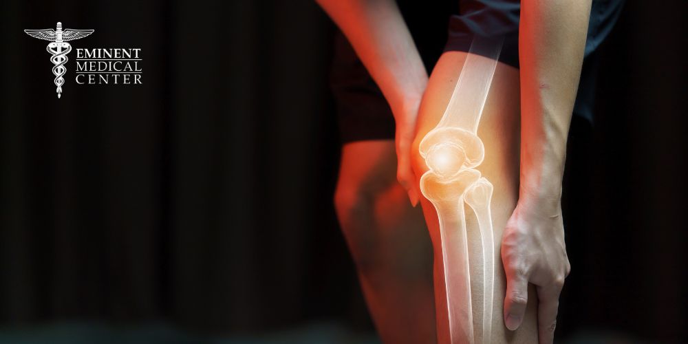 Richardson kneecap replacement
